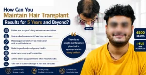 How Can You Maintain Hair Transplant Results for 5 Years