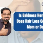 Is Baldness Hereditary