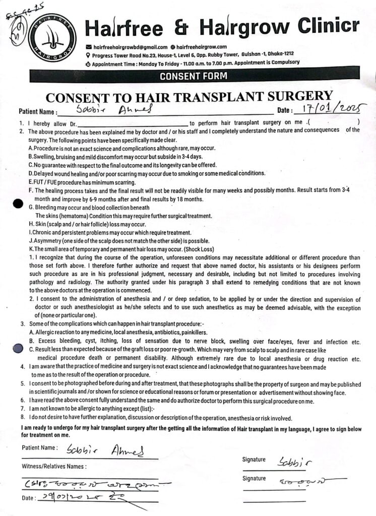consent for hair transplant surgery